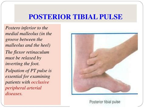 tibialis posterior palpation